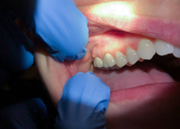 Best Emergency Dentist for Knocked-Out Tooth in Santa Nella, CA